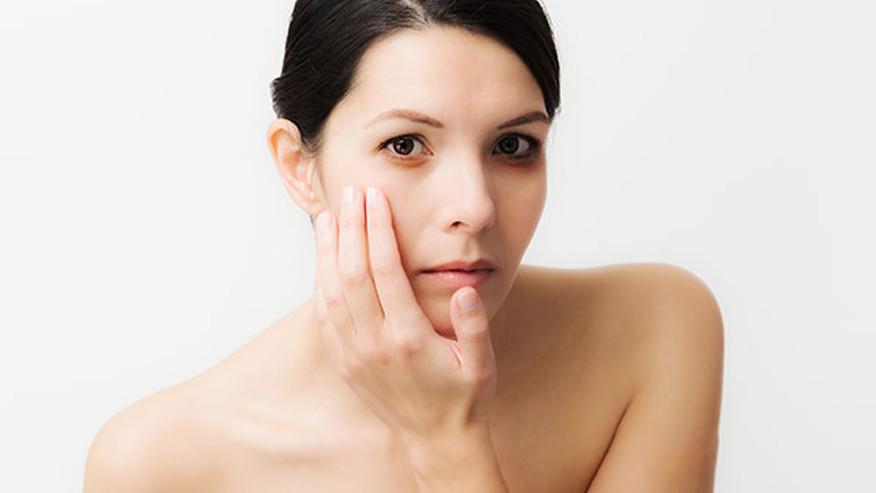 怎么去除黑眼圈